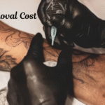 Tattoo Removal Cost
