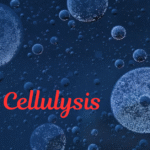 Cellulysis