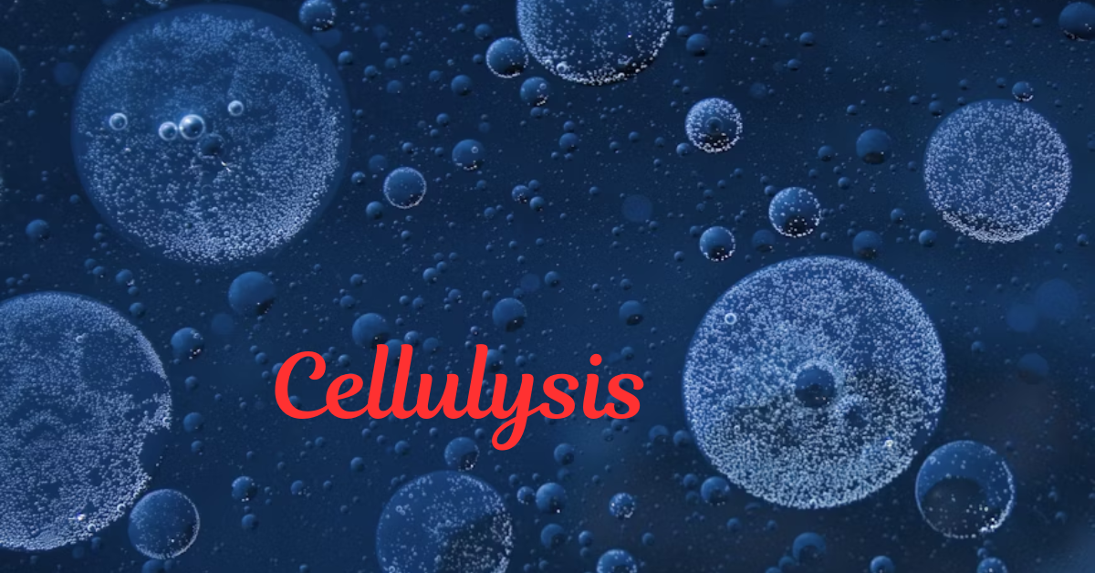 Cellulysis